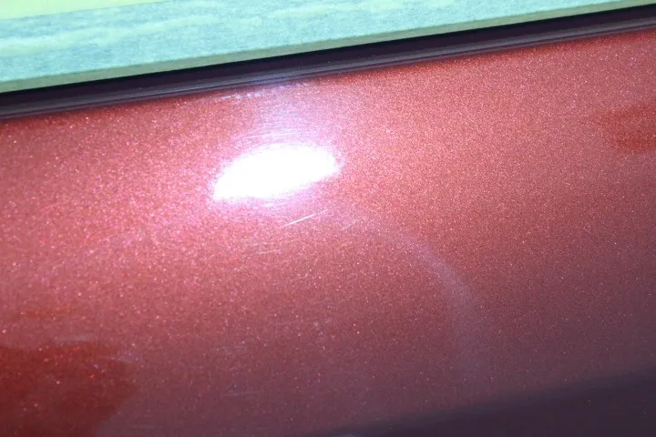 オーロラ傷とは